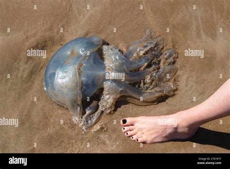Black Toenails Hi Res Stock Photography And Images Alamy