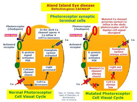 Aland Island Eye Disease Hereditary Ocular Diseases