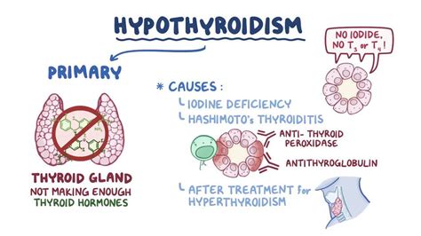 Hypothyroidism Medications Osmosis