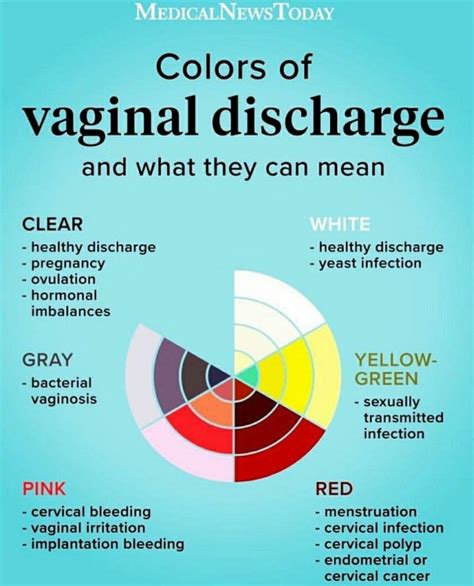 vaginal discharge causes colour prevention tips ultimate guide my xxx hot girl