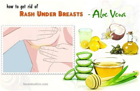 17 Tips On How To Get Rid Of Rash Under Breasts Fast