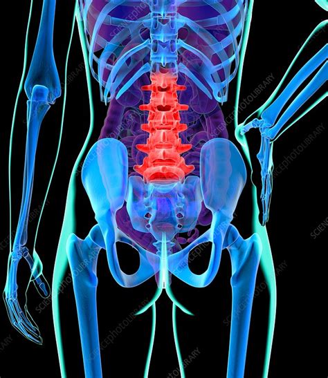 Back Pain Conceptual Artwork Stock Image F0049099 Science Photo