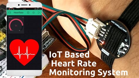 Iot Based Heart Defect Monitoring System Using Ecg Porn Sex Picture