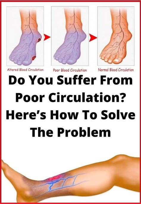 Do You Suffer From Poor Circulation Heres How To Solve The Problem