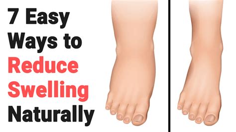 When To Go To The Doctor About Swelling Of Legs