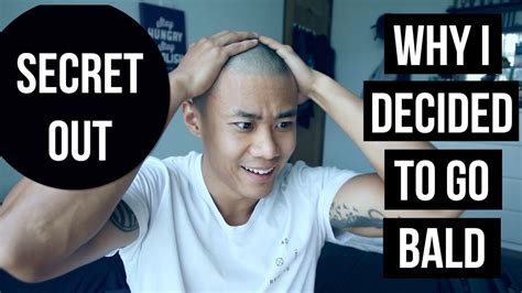 Why I Decided To Go Bald Youtube