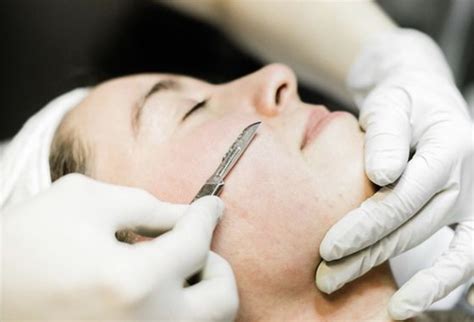 Dermaplaning Quanto Tempo Dura