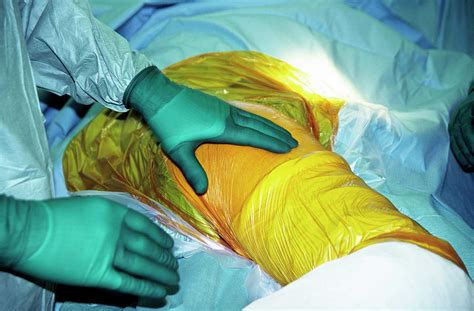 Hip Replacement Surgery Photograph By Antonia Reevescience Photo Library