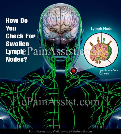 How Do You Check For Swollen Lymph Nodes