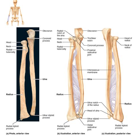 Radius And Ulna Of The Right Forearm Anatomy Bones Medical Anatomy