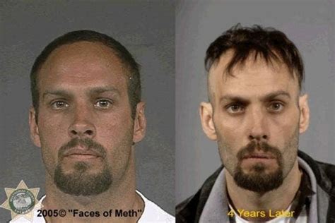 Meth Before And After Raybon