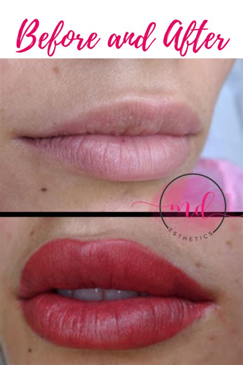 Permanent Lipstick Before And After Permanent Lipstick Cosmetic Dermatology Lips
