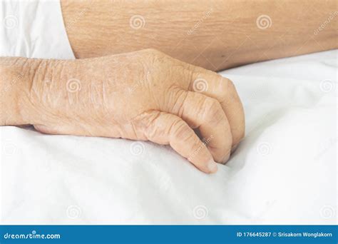 Patient Hands And Subcutaneous Swelling Stock Image Image Of Skin