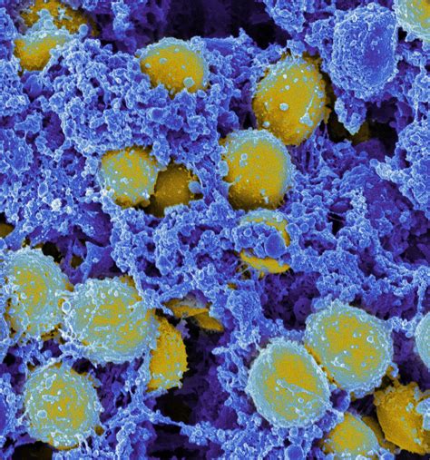 Aureus and was first isolated in the early 1960s, shortly after methicillin came into use as an antibiotic. Nieuw antibioticum tegen superbacterie MRSA - New Scientist