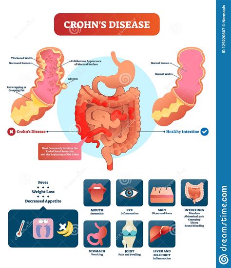 Simple Science: How to Make a Volcano with Kids