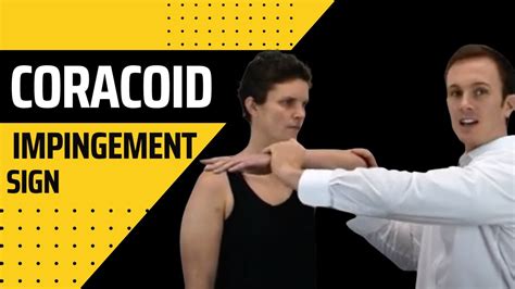 Coracoid Impingement Sign Modified Hawkins Kennedy Shoulder