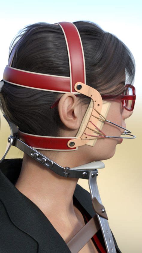 Orthodontic Headgear Braces Ideas In Headgear Braces Braces Girls