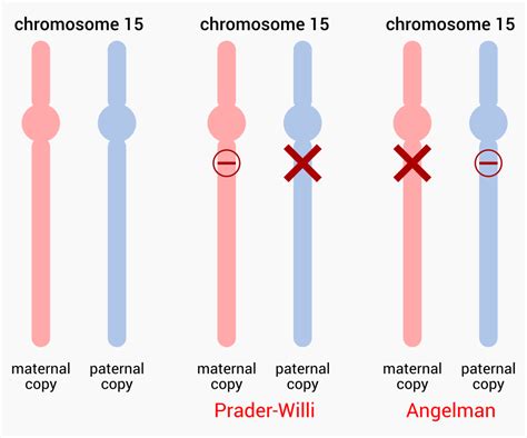 Prader Willi And Angelman Syndromes Chromosome 15