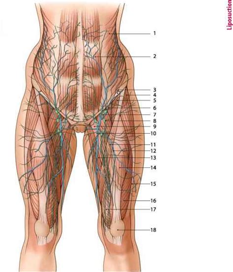 Anatomy Of Liposuction Of Theabdomen Hips Thighs Aesthetic Surgery