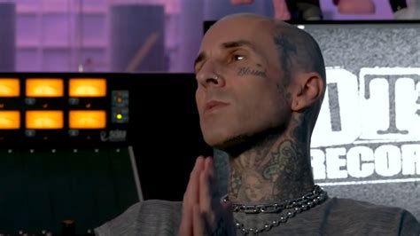 Travis Barker Shares Gnarly Hand Injury Weeks Before Blink 182 Reunion