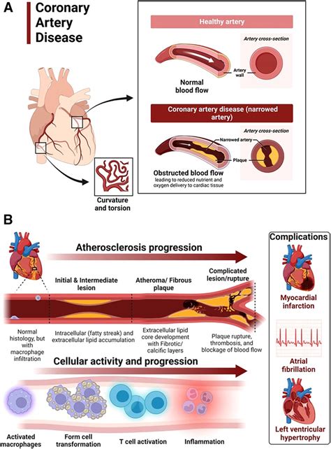 Frontiers Hypertensive Heart Disease Risk Factors Complications And