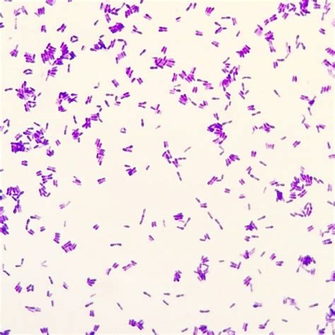 Corynebacterium Bacteriologia