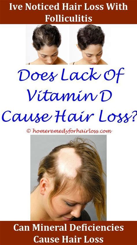 Vitamin D And Hair Growth These Will Be The 10 Biggest Hair Trends Of