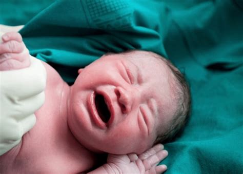 تفسير حلم الولادة القيصرية