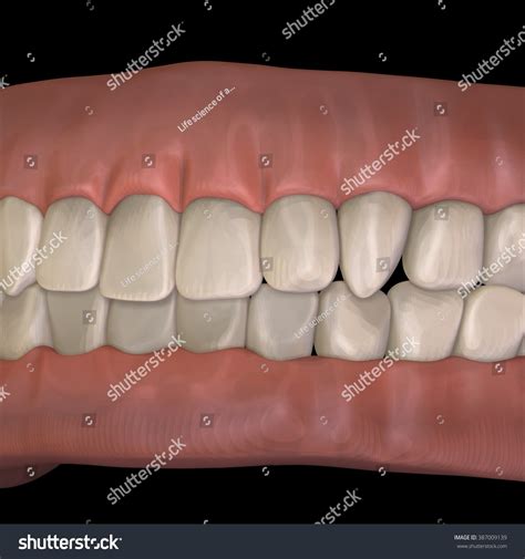 Human Body Teeth Stock Illustration 387009139 Shutterstock
