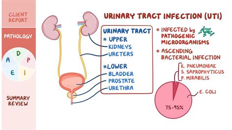 Urinary Tract Infections UTIs Nursing Process ADPIE Osmosis