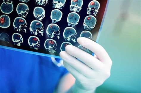 14 Warning Signs Of Brain Tumors You Should Not Ignore