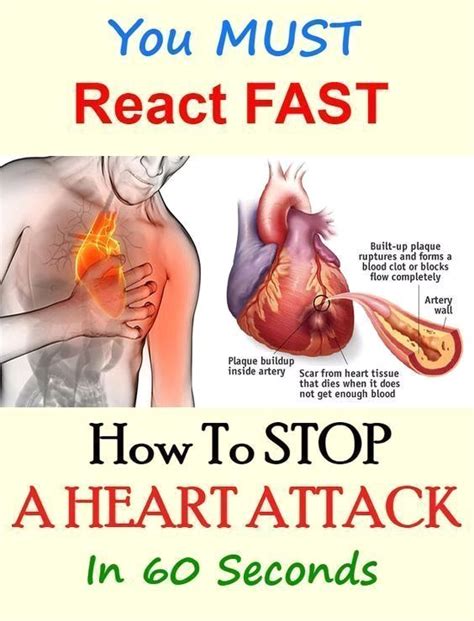 How To Stop A Heart Attack In 1 Minute Heart Attack Remedies Health