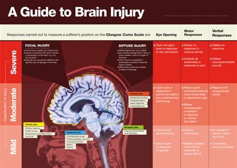 Brain Injury Solicitors Head Injury Compensation Claims Bbk