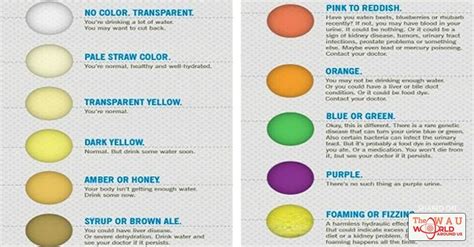 Urology Infographic What Your Urines Color Means Scaled Mcesda 8
