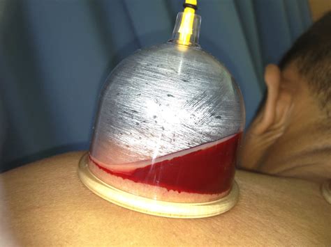 We did not find results for: BEKAM ALYAKIN 2U