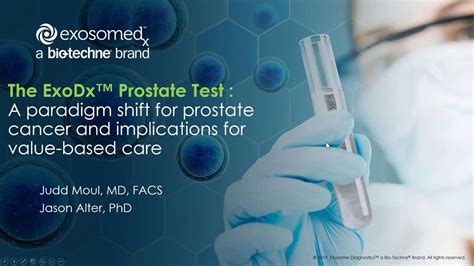 The Exodx™ Prostate Test Prostate Cancer And Implications For Value Based Care Part 1 Youtube