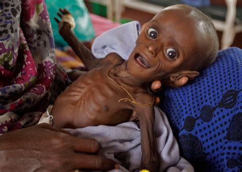 Thousands of children who have been driven from their homes by war in south sudan and congo are hungry and at risk of feed the hungry is on the ground in ugandan refugee camps feeding thousands of children every day. The Dirty Reason Why Starving Children Are The Face Of ...