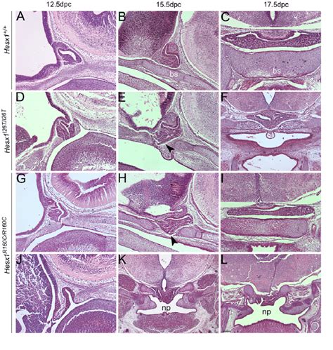 Pituitary Gland Histology Diagram