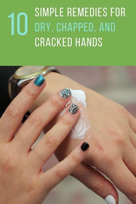 10 simple home remedies for cracked hands