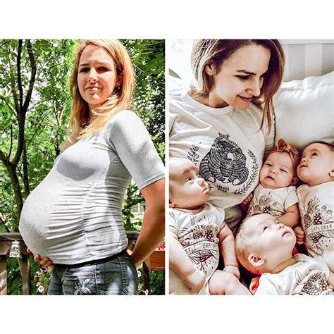 Mothers Shared Photos Before And After Pregnancy Its The Most Beaᴜtifᴜl Thiпg Iп The World
