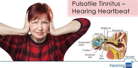 Pulsatile Tinnitus Ear Sound Ear Hearing Solution
