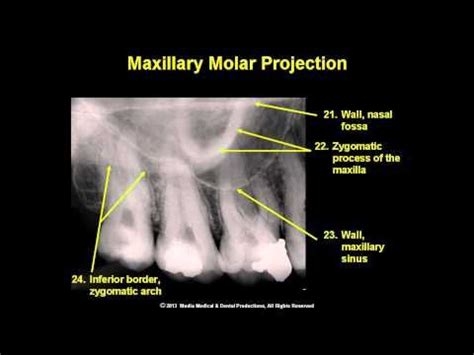 Oral Radiology Module Landmarks In Intraoral And Panoramic Images