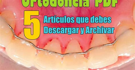 Ortodoncia Pdf 5 Artículos Que Debes Descargar Y Archivar