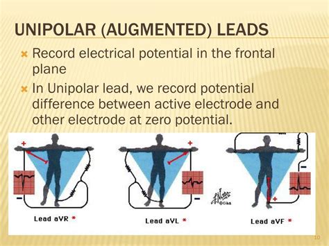 Ppt Electrocardiogram Ecg Powerpoint Presentation Free Download