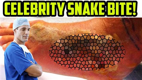 Ultimate Pit Viper Bite Bear Grylls Producer Deadly Snake Bite Youtube