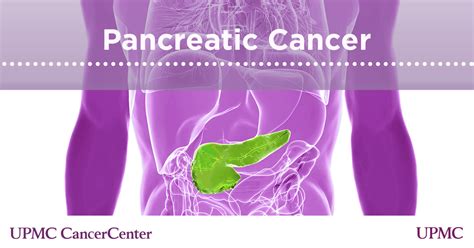 Infographic Pancreatic Cancer Risks Types Stages Upmc