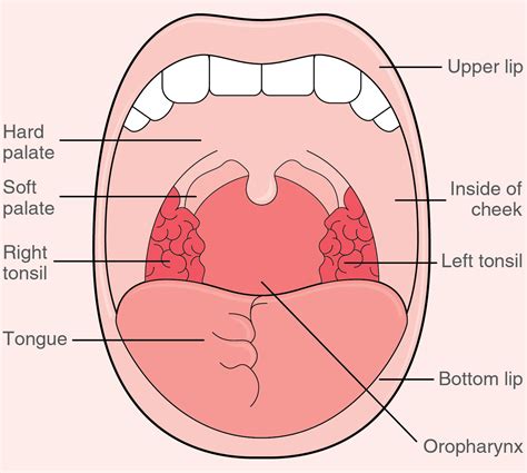 Tonsil Cancer Prognosis Stage 4