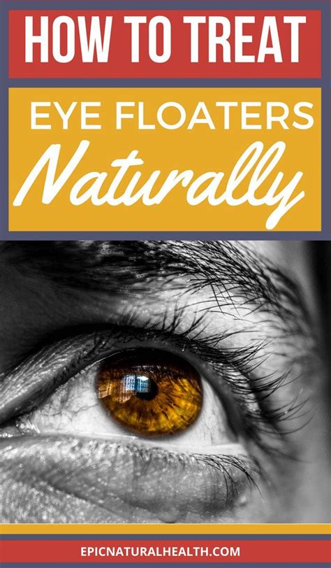 Natural Health Remedies Eye Floaters Cure Eye Health Remedies Eye