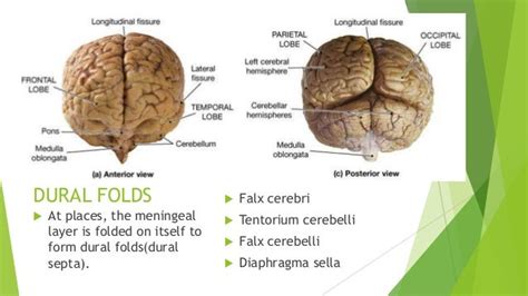 Dural Folds And Cavernous Sinus