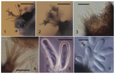 Conidiophores And Conidia Typical Of Cladosporium Herbarum Originate